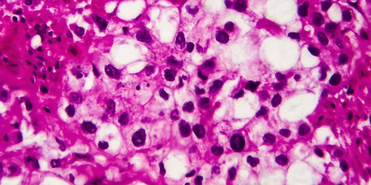 Valar Labs Partners with PathNet Lab to Expand AI Bladder Cancer Diagnostics