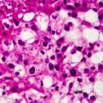 Valar Labs Partners with PathNet Lab to Expand AI Bladder Cancer Diagnostics