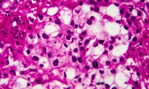 Valar Labs Partners with PathNet Lab to Expand AI Bladder Cancer Diagnostics