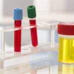 Study Identifies Blood, Urine Tests That Could Reduce Spinal Taps in Newborns