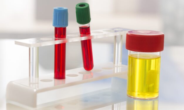 Study Identifies Blood, Urine Tests That Could Reduce Spinal Taps in Newborns