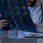 Blood Test Shows Chemotherapy Response in Glioblastoma After First Treatment Dose