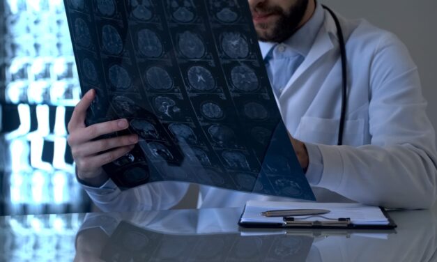 Blood Test Shows Chemotherapy Response in Glioblastoma After First Treatment Dose