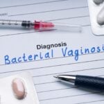 Roche Receives CE Mark for PCR Test Targeting Bacterial Vaginosis and Candida Vaginitis