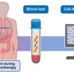 Cell-Free DNA Test May Identify Immunotherapy Adverse Events Earlier