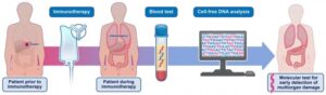 Cell-Free DNA Test May Identify Immunotherapy Adverse Events Earlier