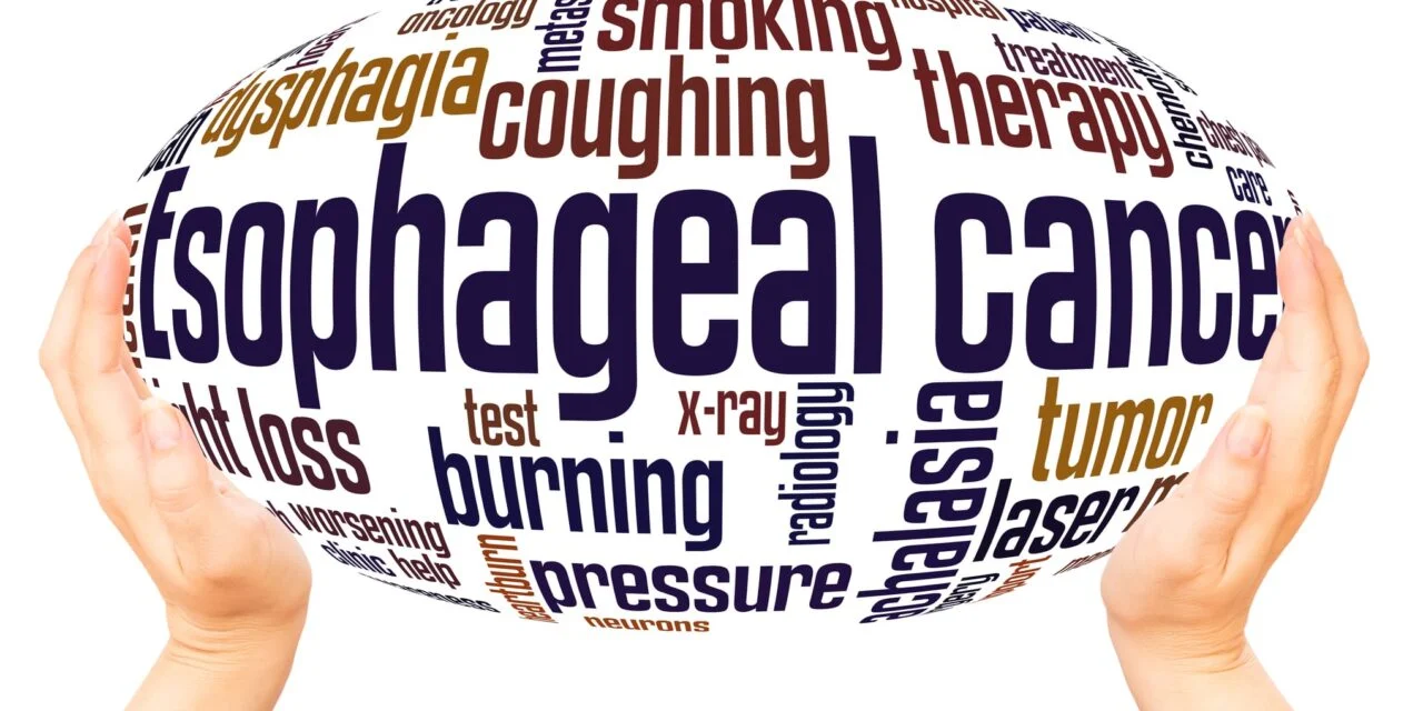 Meta-Analysis Backs TissueCypher as Strong Predictor of Barrett’s EsophagusProgression