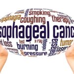 Meta-Analysis Backs TissueCypher as Strong Predictor of Barrett’s EsophagusProgression