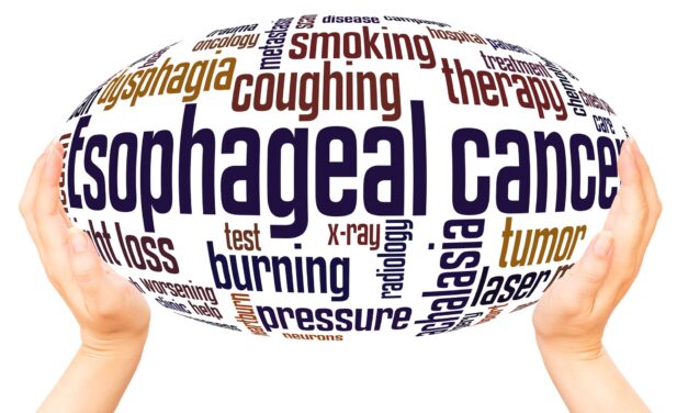 Meta-Analysis Backs TissueCypher as Strong Predictor of Barrett’s EsophagusProgression