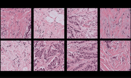 Harvard Researchers Identify Bias in AI Pathology Models