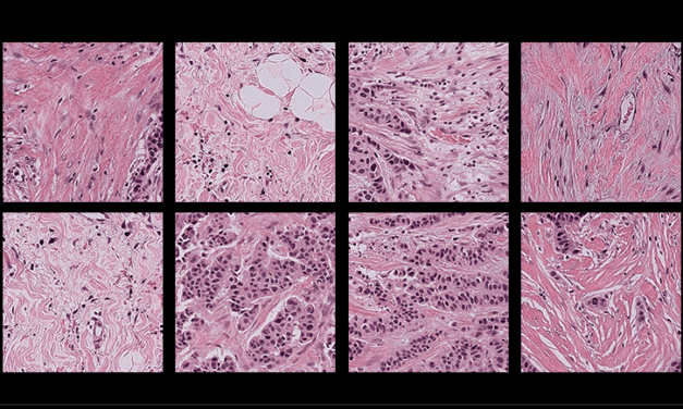 Harvard Researchers Identify Bias in AI Pathology Models