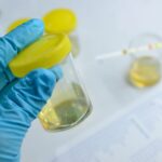 Yenos Analytical Launches Multi-Cancer Early Detection Urine Test
