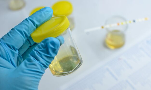 Yenos Analytical Launches Multi-Cancer Early Detection Urine Test
