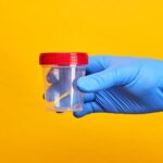 Urine Test Can Diagnose Bladder Cancer, Study Shows