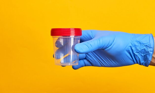 Urine Test Can Diagnose Bladder Cancer, Study Shows