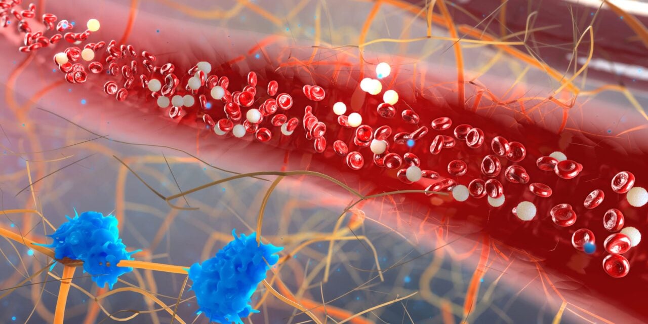 Researchers Identify Four New Markers for Detecting Aggressive Breast Cancer Cells in Blood