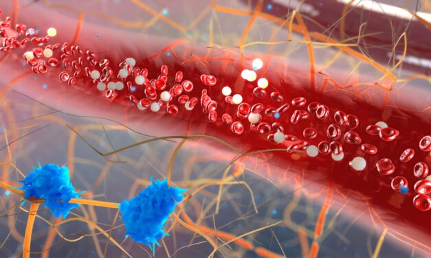 Researchers Identify Four New Markers for Detecting Aggressive Breast Cancer Cells in Blood