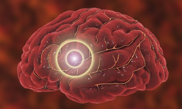 Blood Test Tracks Brain Injury Progression After Stroke