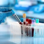 Flow Cytometry Blood Test for Myeloma MRD Detection Launches