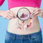 Fecal DNA Methylation Test Shows Promise for Colorectal Cancer Screening