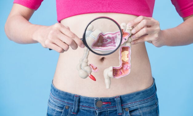 Fecal DNA Methylation Test Shows Promise for Colorectal Cancer Screening