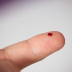 Home AI Blood Testing Device Gains FDA Clearance for Point of Care