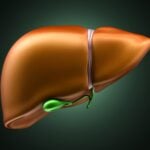 Blood Test Could Enable Earlier Detection of Gallbladder Cancer