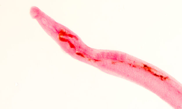 New US Lab Panel Targets Hard-to-Diagnose Liver Fluke Infections