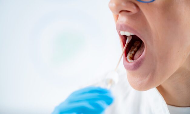 Thermo Fisher Launches Pharmacogenetic Test for Transplant Drug Dosing