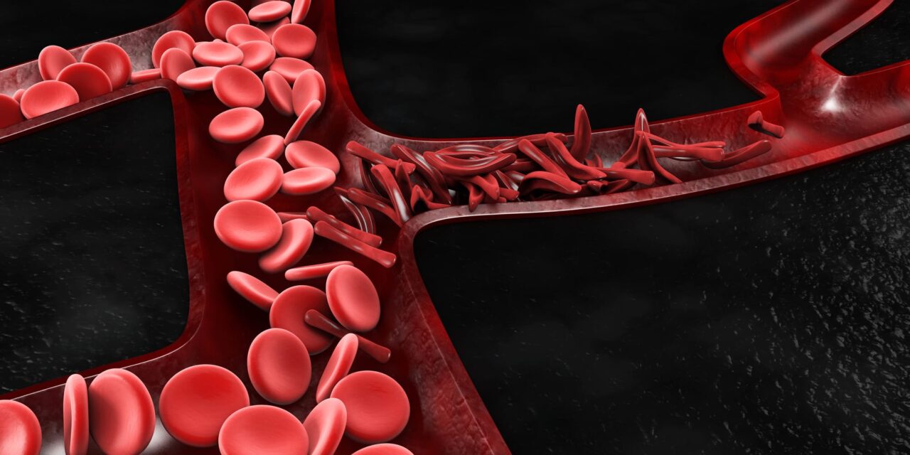 FDA Grants Breakthrough Device Designation for Hemoglobin Variant Test