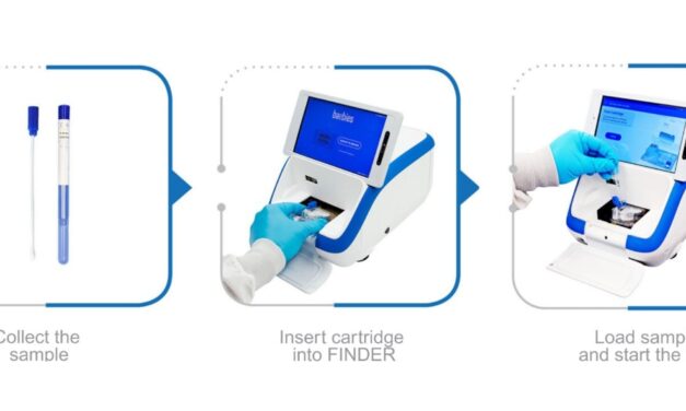 Rapid Molecular Test for Flu and COVID-19 on FINDER Platform Gets FDA Clearance and CLIA-Waiver