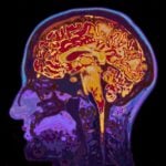 Concussion Blood Test Advances Toward FDA Submission With Point-of-Care Collaboration
