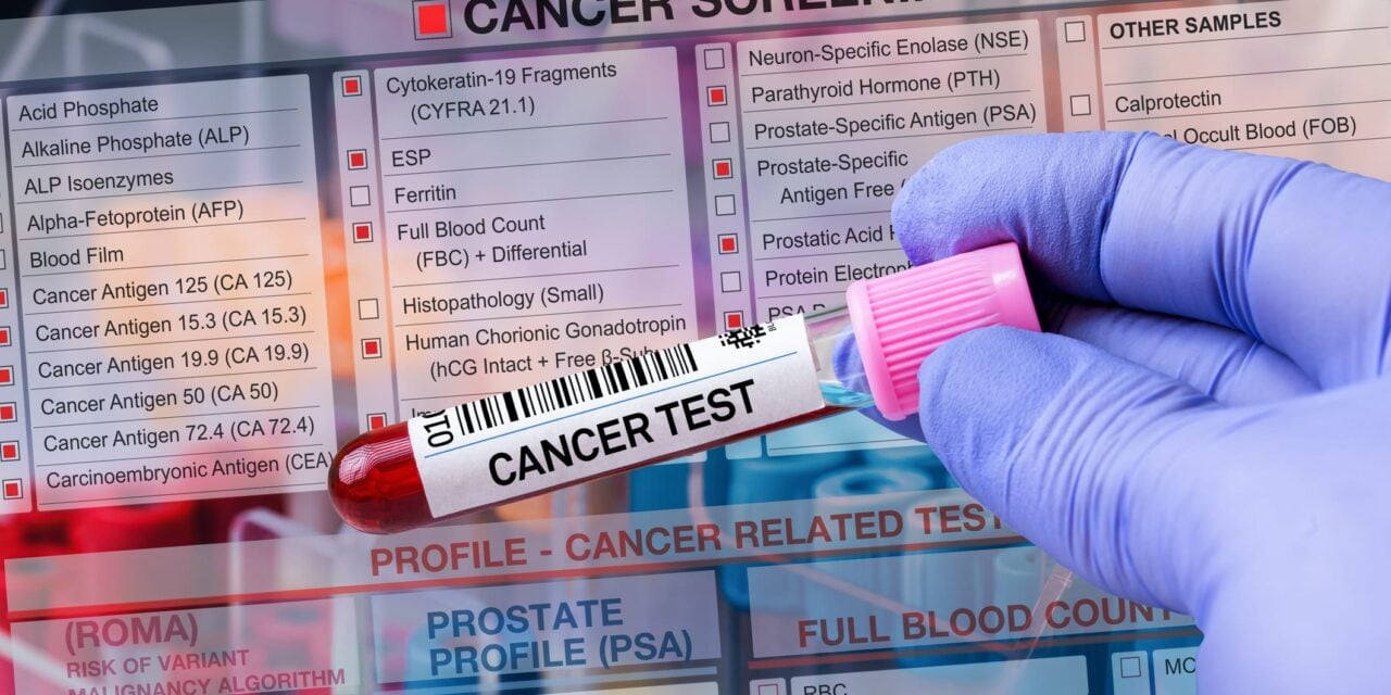 Protein Biomarker Tests May Detect Cancer Earlier Than DNA-Based Methods