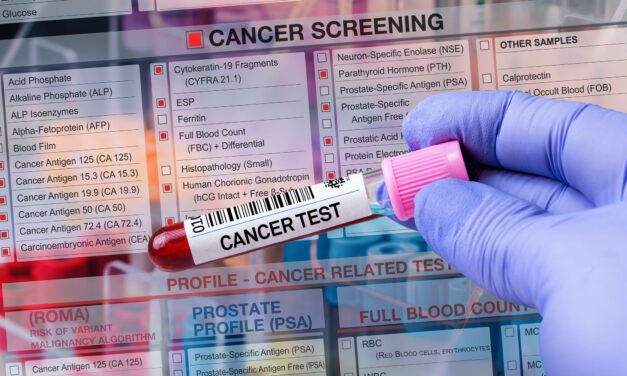 Protein Biomarker Tests May Detect Cancer Earlier Than DNA-Based Methods