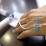 New AI Test Estimates Individualized Chemotherapy Benefit in Breast Cancer Patients