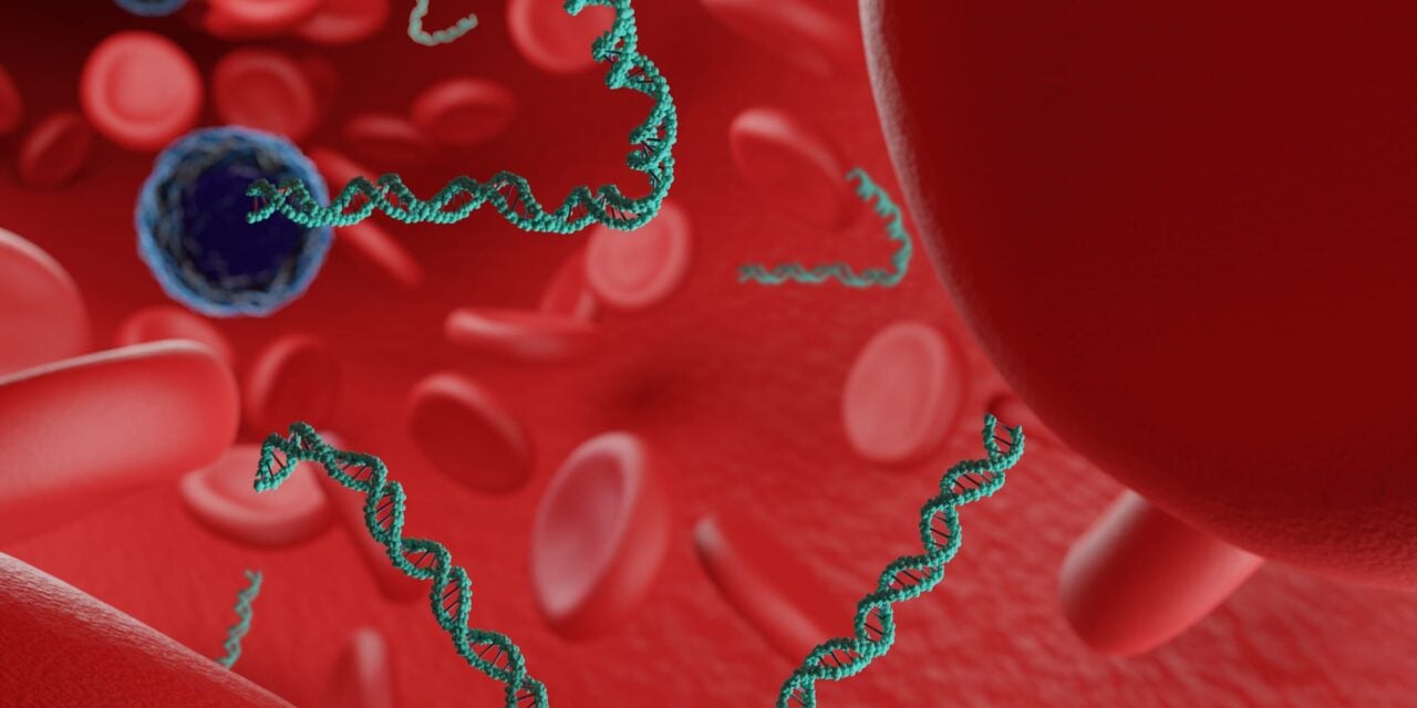 Ultrasensitive ctDNA Test Outperforms Standard Metrics in Predicting Breast Cancer Outcomes After Neoadjuvant Therapy