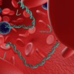 Ultrasensitive ctDNA Test Outperforms Standard Metrics in Predicting Breast Cancer Outcomes After Neoadjuvant Therapy