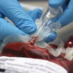 New 4-in-1 Blood Donor Screening Assay Targets HIV, Hepatitis B, C, and E in a Single Workflow