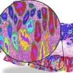 Deep Learning Pathology Models Caught ‘Cheating,’ Study Finds