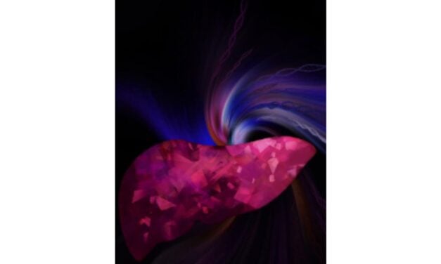 AI Liquid Biopsy Test Detects Early Liver Fibrosis and Cirrhosis