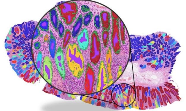 Deep Learning Pathology Models Caught ‘Cheating,’ Study Finds