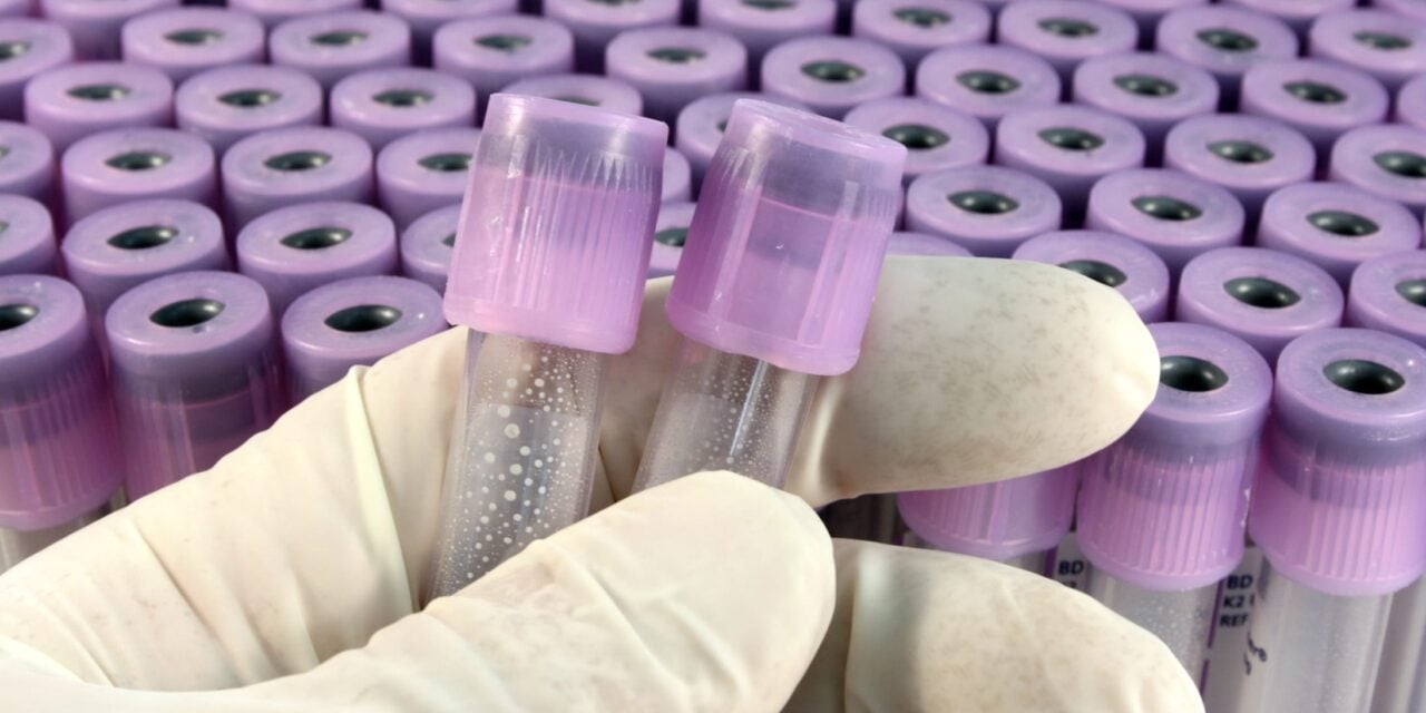 Spatial Biology Workflow Gains New Panels and Amplification Kits