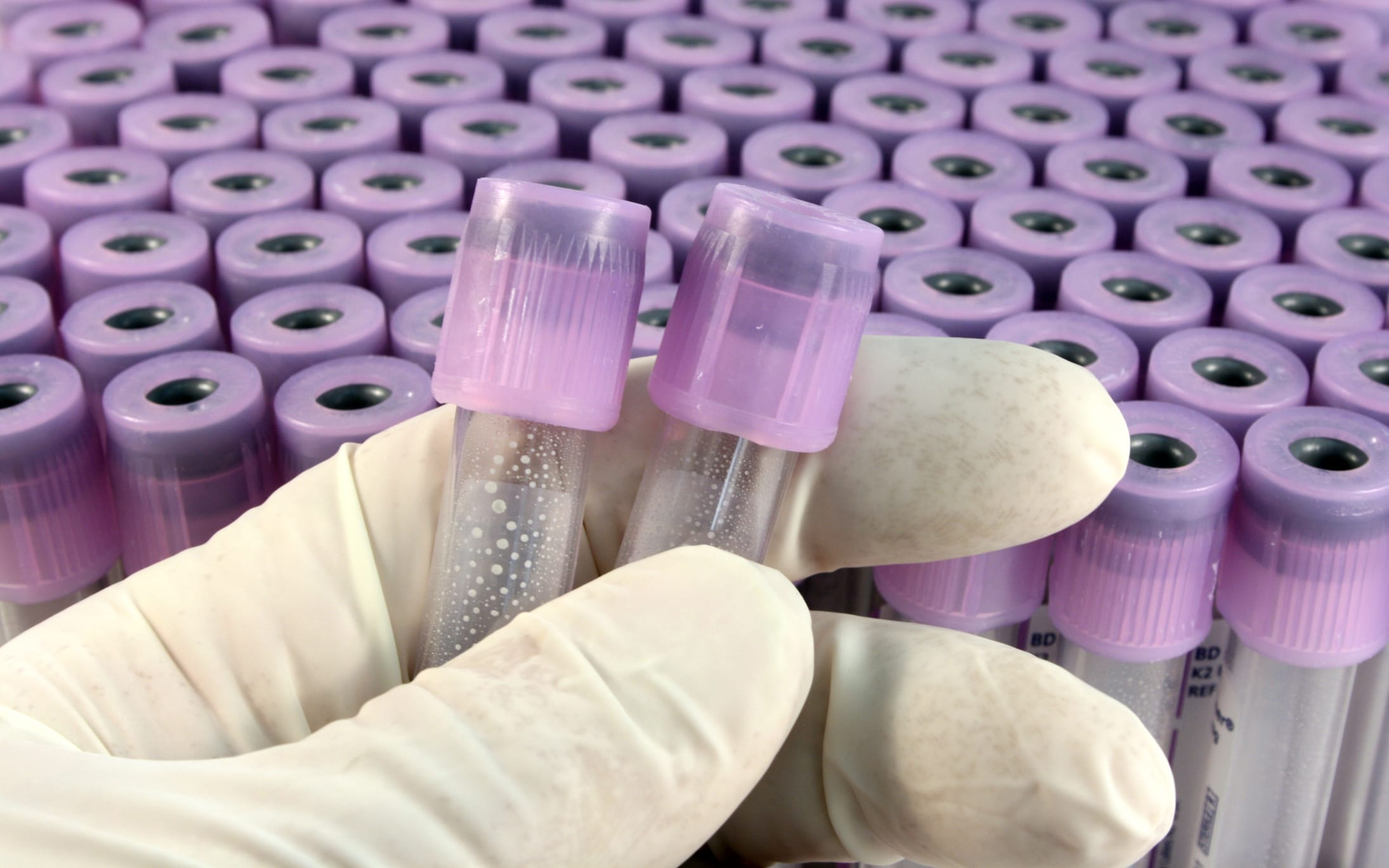 Spatial Biology Workflow Gains New Panels and Amplification Kits ...