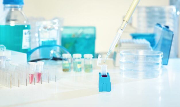 Nucleosome Liquid Biopsy Shows Promise for Lung Cancer Risk Stratification