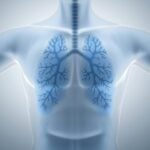 Largest Lung Nodule Biomarker Validation Study Backs Earlier Cancer Detection