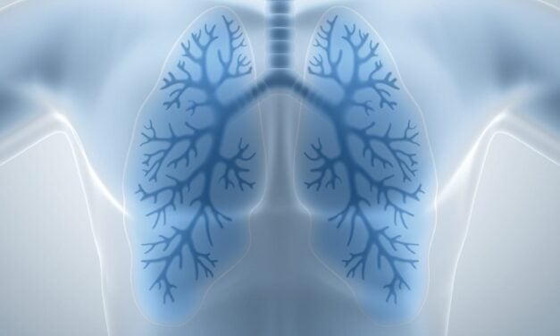 Largest Lung Nodule Biomarker Validation Study Backs Earlier Cancer Detection