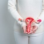 FDA Approves MyChoice CDx as Companion Diagnostic for Zejula in Ovarian Cancer