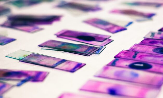 AI Platform Predicts Biomarker Expression from Standard Pathology Slides, With No Additional Staining Required