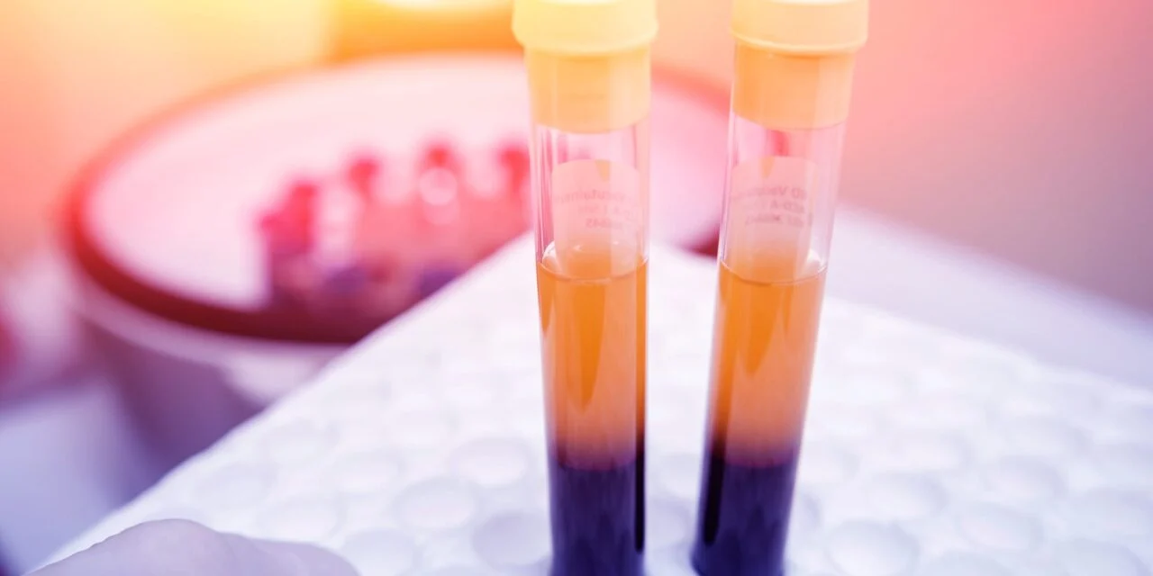 The Power of High-Sensitivity Troponin in Rapid Testing of Cardiovascular Disease 