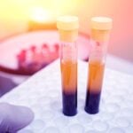 The Power of High-Sensitivity Troponin in Rapid Testing of Cardiovascular Disease 